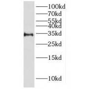 WB analysis of human liver tissue, using HSD17B6 antibody (1/200 dilution).
