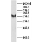 WB analysis of MCF7 cells, using HSD17B7 antibody (1/1000 dilution).