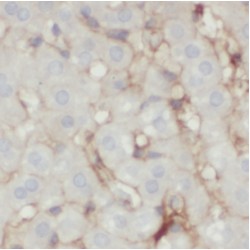 3-Keto-Steroid Reductase (HSD17B7) Antibody