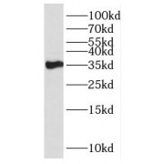 WB analysis of MCF7 cells, using HSD17B7 antibody (1/1000 dilution).