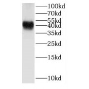 WB analysis of human adrenal gland tissue, using HSD3B2 antibody (1/1500 dilution).
