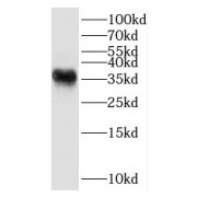 WB analysis of mouse liver tissue, using HSD3B7 antibody (1/500 dilution).