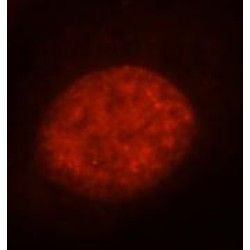Heat Shock Factor Protein 1 (HSF1) Antibody