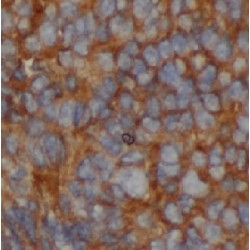 Heat Shock 70 kDa Protein 1A (HSPA1A) Antibody