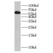 WB analysis of human brain tissue, using HSPA13 antibody (1/500 dilution).