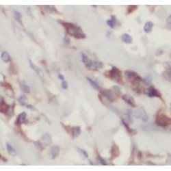 Heat Shock 70 kDa Protein 6 (HSPA6) Antibody