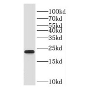 WB analysis of human skeletal muscle tissue, using HSP27 antibody (1/300 dilution).