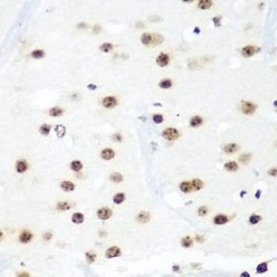 HIV TAT Specific Factor 1 (HTATSF1) Antibody