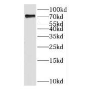 WB analysis of MCF-7 cells, using TRMT2A antibody (1/600 dilution).