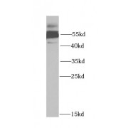 WB analysis of mouse lung tissue, using HTR3A antibody (1/1000 dilution).