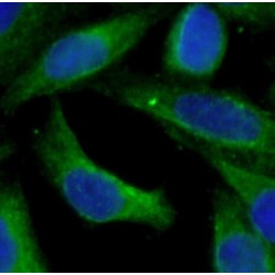 5-Hydroxytryptamine Receptor 4 (HTR4) Antibody