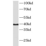 WB analysis of HeLa cells, using HTR4 antibody (1/500 dilution).