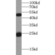 WB analysis of human plasma tissue, using human IgG antibody (1/10000 dilution).