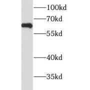 WB analysis of mouse testis tissue, using HYAL4 antibody (1/300 dilution).
