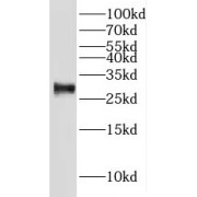 WB analysis of mouse testis tissue, using IAH1 antibody (1/500 dilution).