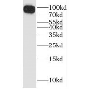 WB analysis of mouse brain tissue, using Icam1 antibody (1/2000 dilution).