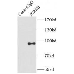 Intercellular Adhesion Molecule 1 (ICAM-1) Antibody