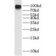 WB analysis of rat heart tissue, using ICAM-1 antibody (1/800 dilution).