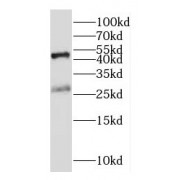 WB analysis of Jurkat cells, using ICOS antibody (1/300 dilution).