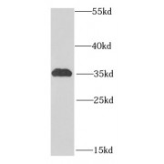 WB analysis of mouse kidney tissue, using ICOSLG antibody (1/1000 dilution).