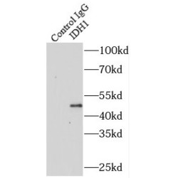 Isocitrate Dehydrogenase 1, Soluble (IDH1) Antibody