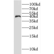 WB analysis of human skeletal muscle tissue, using IDH3A antibody (1/1200 dilution).