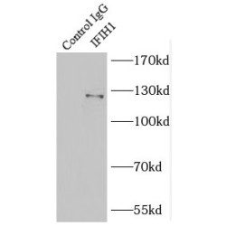 Interferon Induced With Helicase C Domain 1 (IFIH1) Antibody