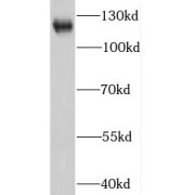 WB analysis of Jurkat cells, using IFIH1 antibody (1/1500 dilution).