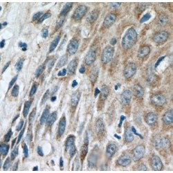 Interferon Induced Protein With Tetratricopeptide Repeats 5 (IFIT5) Antibody
