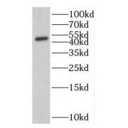 WB analysis of A375 cells, using IFIT5 antibody (1/200 dilution).