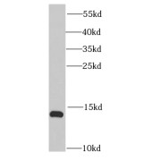 WB analysis of K-562 cells, using IFITM1-Specific antibody (1/40000 dilution).
