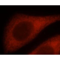Interferon-Induced Transmembrane Protein 3 (IFITM3) Antibody