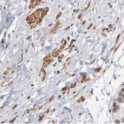 Intraflagellar Transport Protein 57 Homolog (IFT57) Antibody