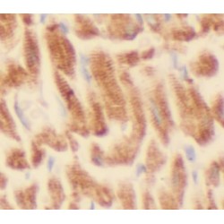 Immunoglobulin Binding Protein 1 (IGBP1) Antibody