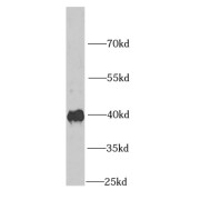 WB analysis of K-562 cells, using IGBP1 antibody (1/1000 dilution).