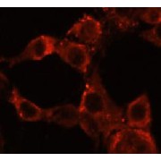 abx234170