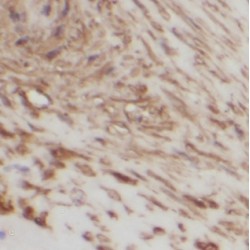 Insulin Like Growth Factor Binding Protein 1 (IGFBP1) Antibody