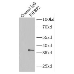 Insulin Like Growth Factor Binding Protein 2 (IGFBP2) Antibody