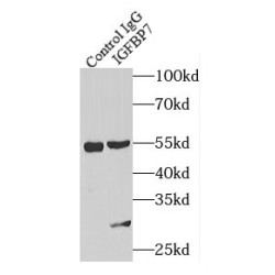 Insulin Like Growth Factor Binding Protein 7 (IGFBP7) Antibody