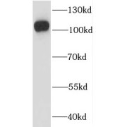 WB analysis of HL-60 cells, using IGHMBP2 antibody (1/600 dilution).