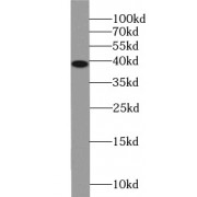 WB analysis of HL-60 cells, using NFKBIA antibody (1/500 dilution).