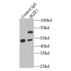 Zinc Finger Protein Helios (IKZF2) Antibody