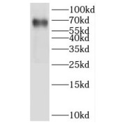 WB analysis of human placenta tissue, using IKZF2 antibody (1/500 dilution).