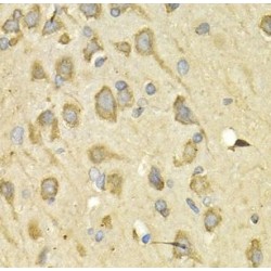 Interleukin 10 Receptor Alpha (IL10RA) Antibody