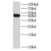 WB analysis of Jurkat cells, using IL10RB antibody (1/500 dilution).