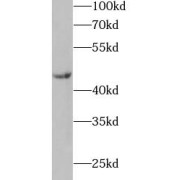 WB analysis of mouse heart tissue, using IL11RA antibody (1/500 dilution).