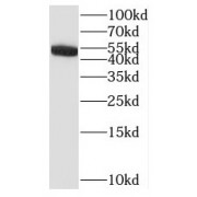 WB analysis of HEK-293 cells, using1IL17RC antibody (1/200 dilution).