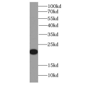 abx234235