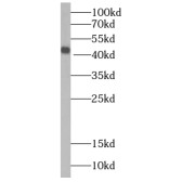WB analysis of Recombinant protein, using IL36RN antibody (1/2000 dilution).