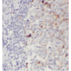 Interleukin-1 Family Member 8 (IL1F8) Antibody
